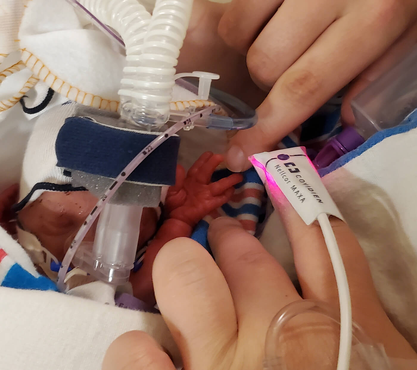 “Otteroo Gave Her Control Over Her Own Little Body,” Says Mom of Preemie